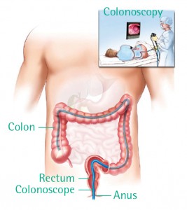 Colorectal4labelled
